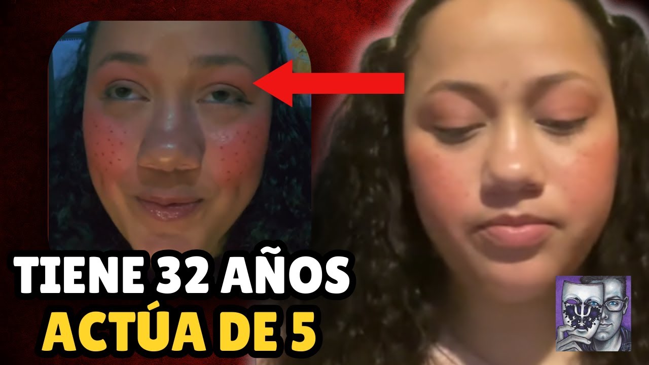 TIENE 32 AÑOS PERO DICE TENER 5: El caso de la Transedad Estrellita que Alumbra (Con PsicoVlog)