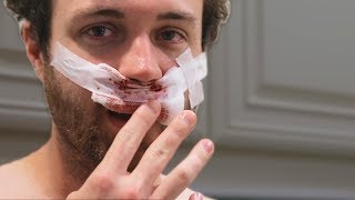 I Got A Nose Job
Sorry for the influx of awesome vlog content. Exciting projects coming soon.
Mariachiando by Doug Maxwell and Jimmy Fontanez
Support us on Patreon: https://www.patreon.com/williamosman
Website: http://www.williamosman.com/
Facebook: https://www.facebook.com/williamosmanscience/
InstaHam: https://www.instagram.com/crabsandscience/
CameraManJohn: http://www.johnwillner.com/ I Got A Nose Job