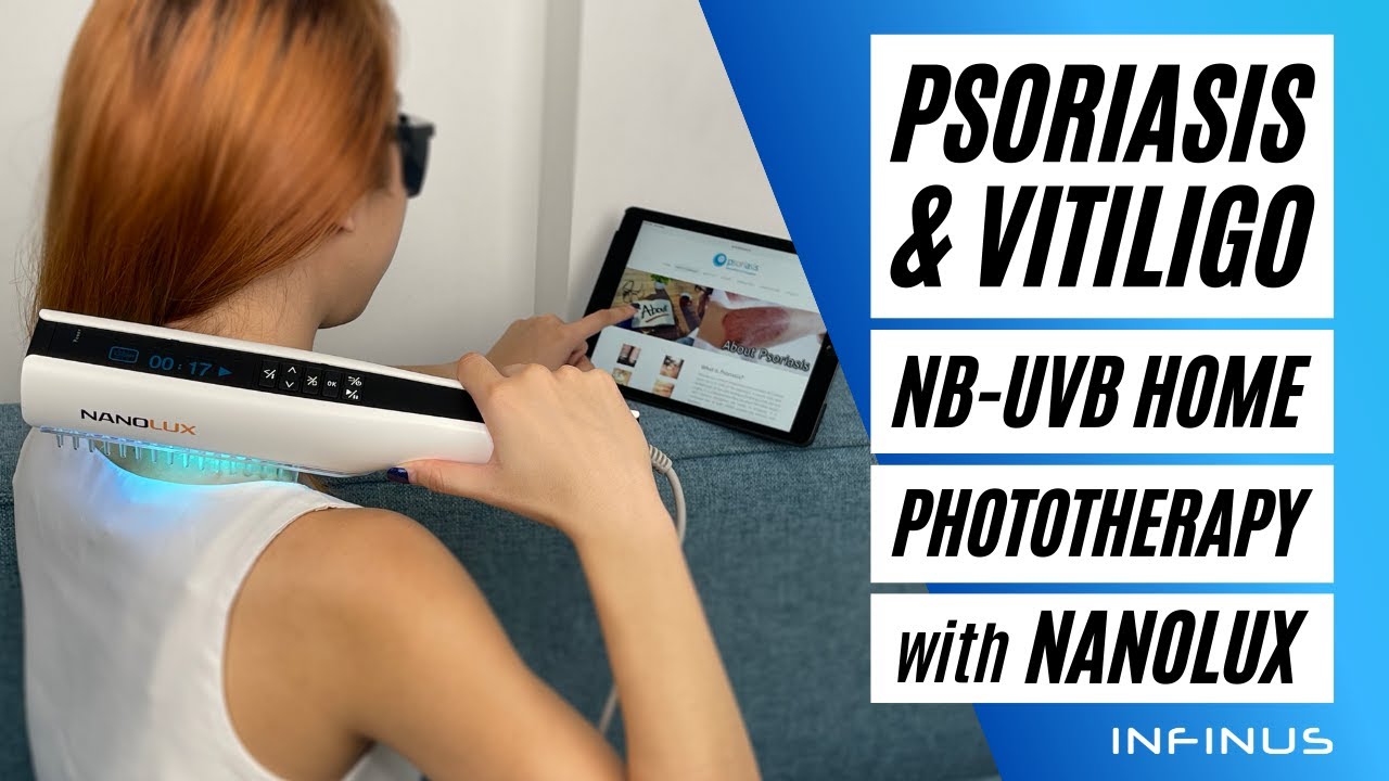 Nanolux NB-UVB Home Phototherapy | Made In Singapore