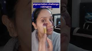 skincareइतना ही जरूरी है,जितना जीने के लिए सांस लेना तो सोचना नहीं है,बस करना है #pigmentation 🫰🫶❤️🌷