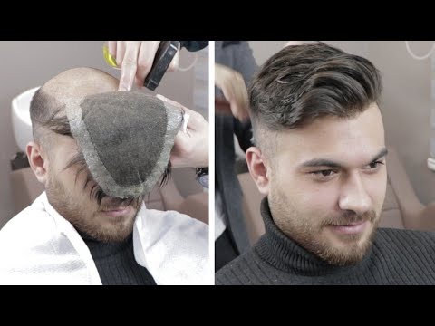 PROTEZ SAÇ ve