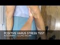 Positive Valgus Stress Test - YouTube