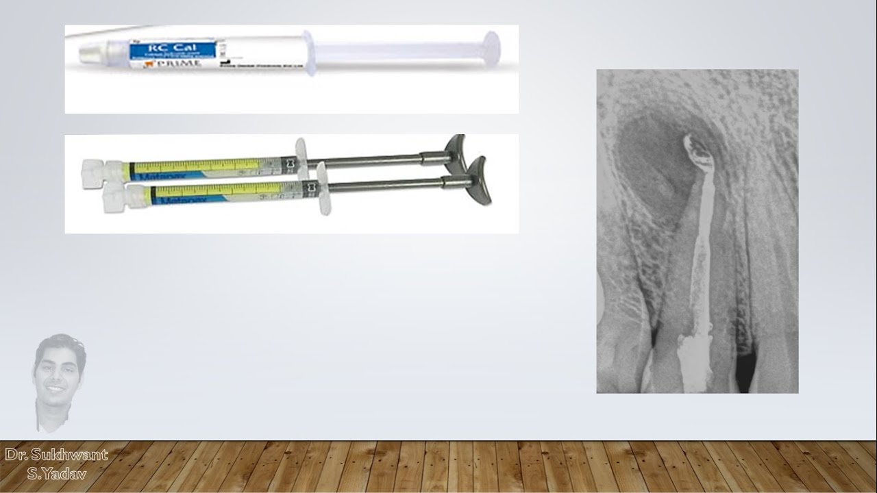 Внутриканальные лекарственные средства