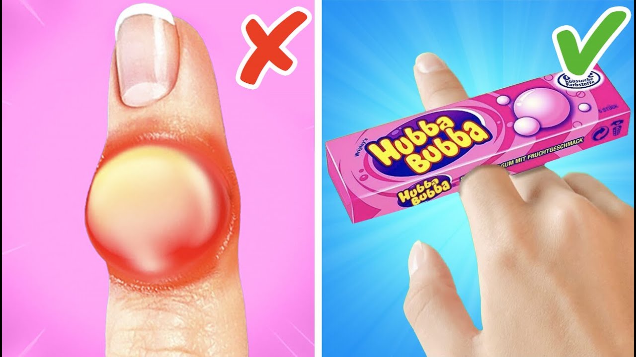 ドクターを呼ぼう！💉Ǻ 親のための緊急ハック｜子育てを楽にする毎日のヒント by 123 GO！