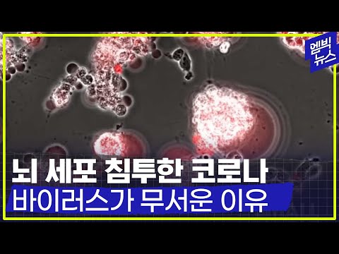 [엠빅네이처] 맨눈으로는 볼 수 없는 놀라운 세계. 그들을 알고 나면 더 놀랍다.