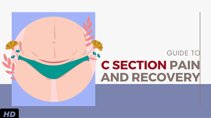 A Guide For C Section Pain And Recovery
