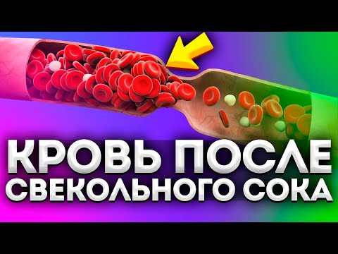 Что творит свекольный сок с сосудами, кровью, ЖКТ и даже... Нужно знать каждому!