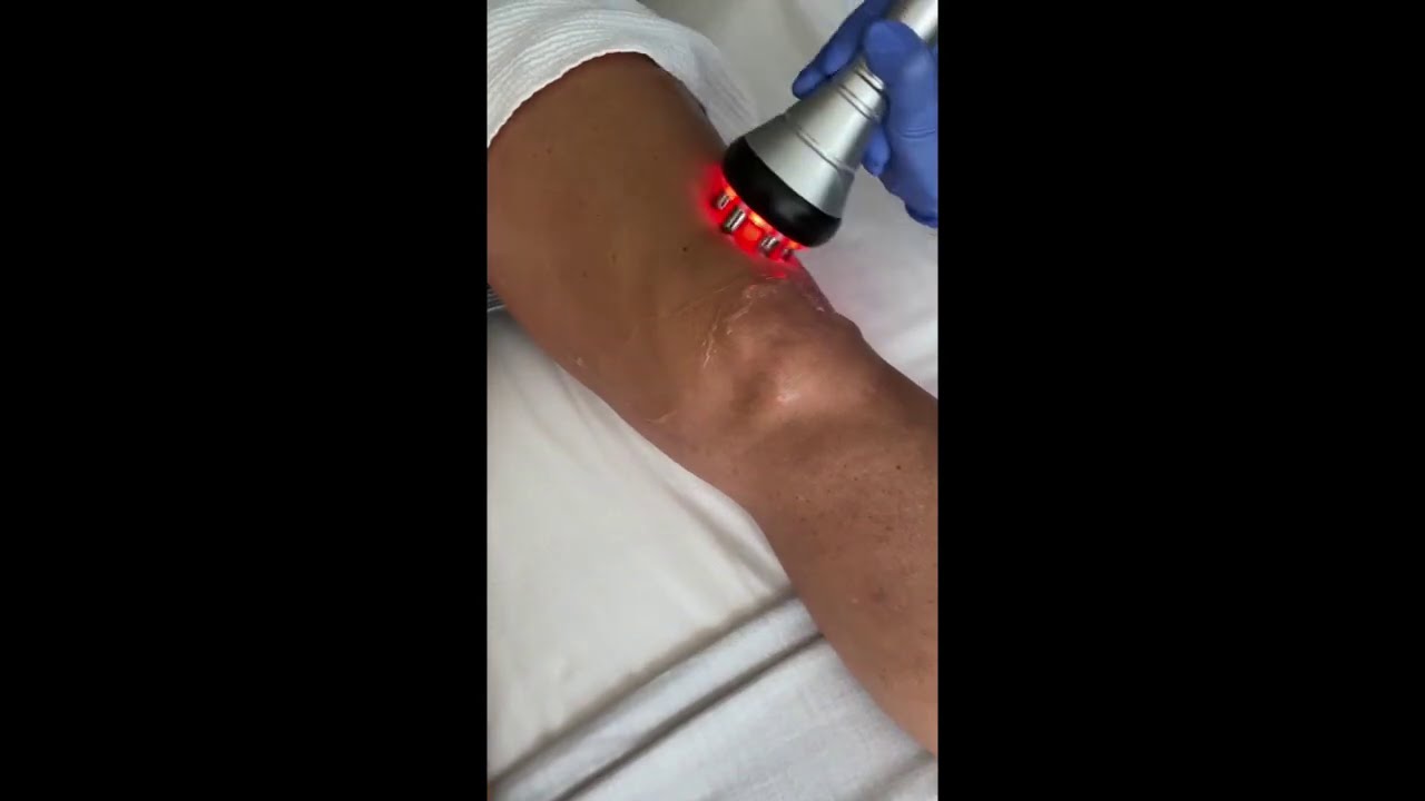 A Demonstration Of Part Of A Cellulite Treatment At Skinspirations