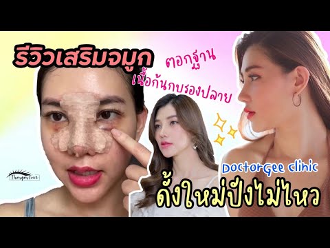 รีวิวเสริมจมูก ตอกฐาน เนื้อก้นกบรองปลาย หมอจีจัดให้แบบปังๆ ที่ DoctorGee Clinic | ThongonTour