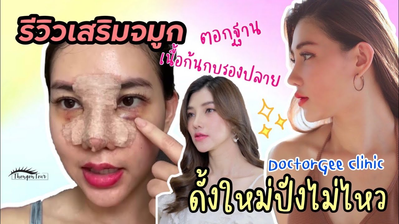 รีวิวเสริมจมูก ตอกฐาน เนื้อก้นกบรองปลาย หมอจีจัดให้แบบปังๆ ที่ DoctorGee Clinic | ThongonTour