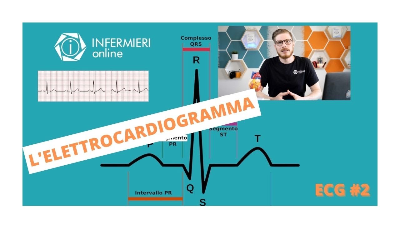 COS E' L' ELETTROCARDIOGRAMMA E COSA CI DICE | ECG #02 | INFERMIERI online