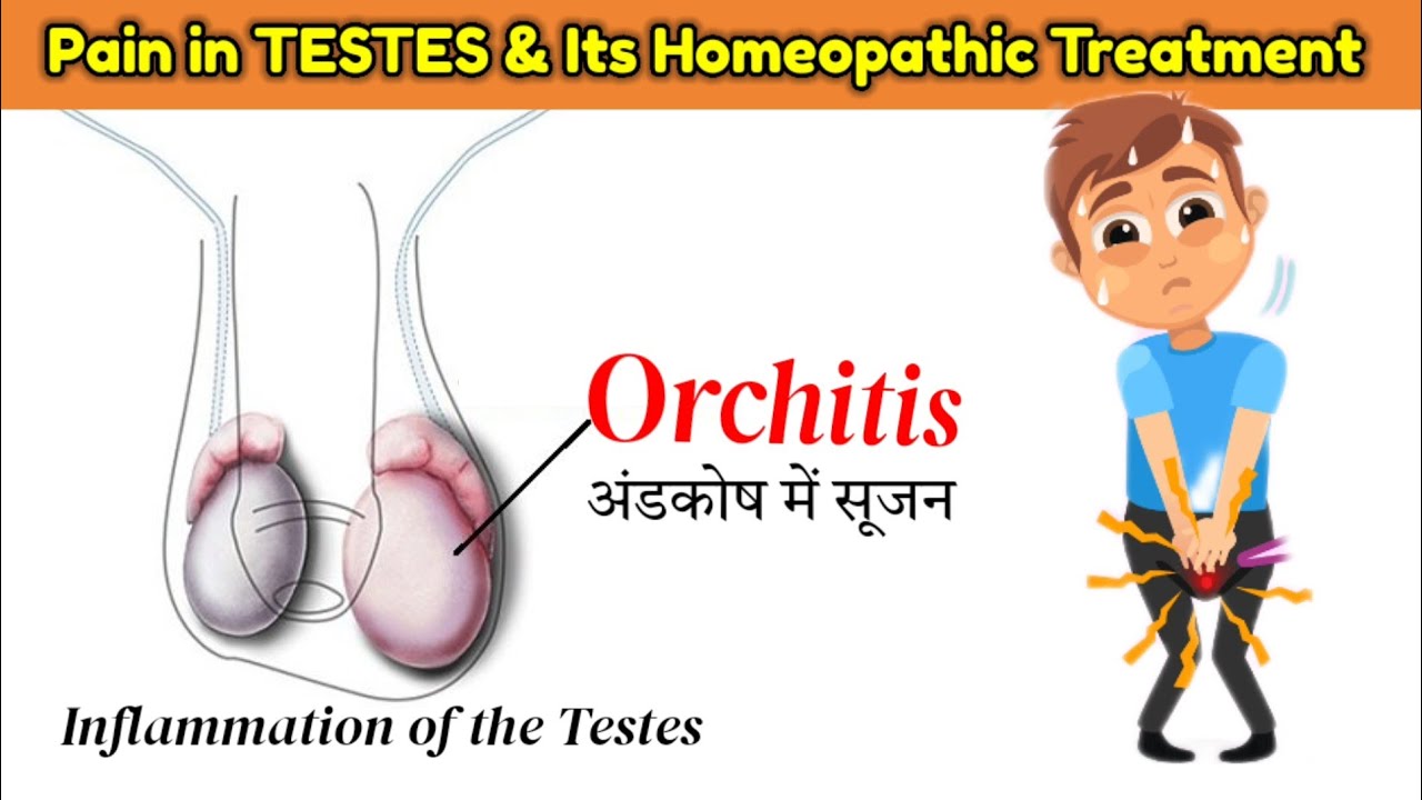 Orchitis | Testicular Swelling | अंडकोष में सूजन | Homeopathic ...
