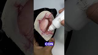 prótesis caracterizadas