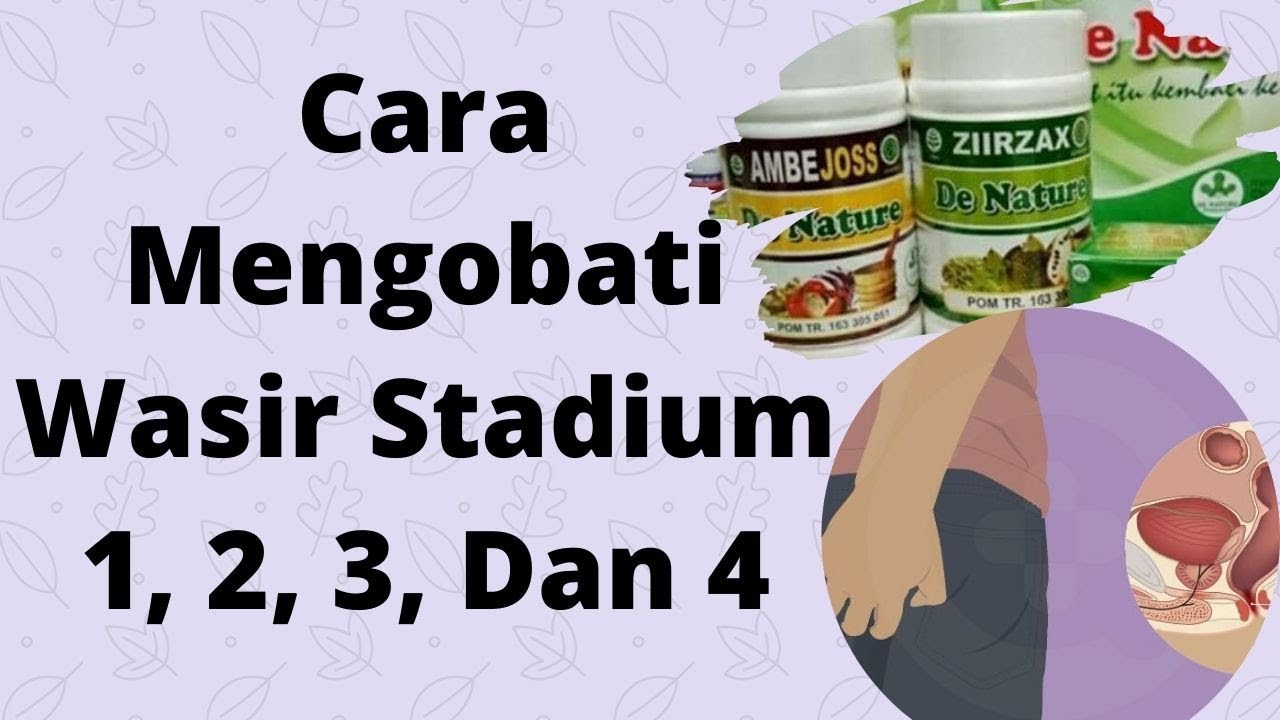 Cara Mengobati Wasir Stadium 1, 2, 3, Dan 4 
