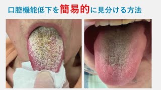 訪問歯科診療を進化させる「摂食嚥下を診る力」 – 株式会社デジタル