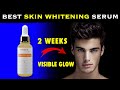 Mars By GHC Skin Glow Serum Review | Get Fair &amp; Glowing Skin In Few Week | Best Skin Whitening Serum