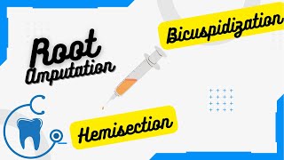 Corrective Surgery terms explained in less than 2 min!