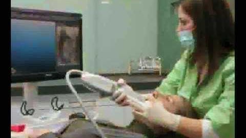 iTero Scanner, Invisalign Digital Impressions - Lake Minnetonka Orthodontics