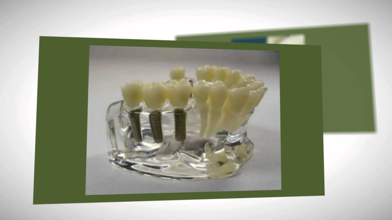 Jackson Tn Dental Implants TN | Dental Associates, Inc.