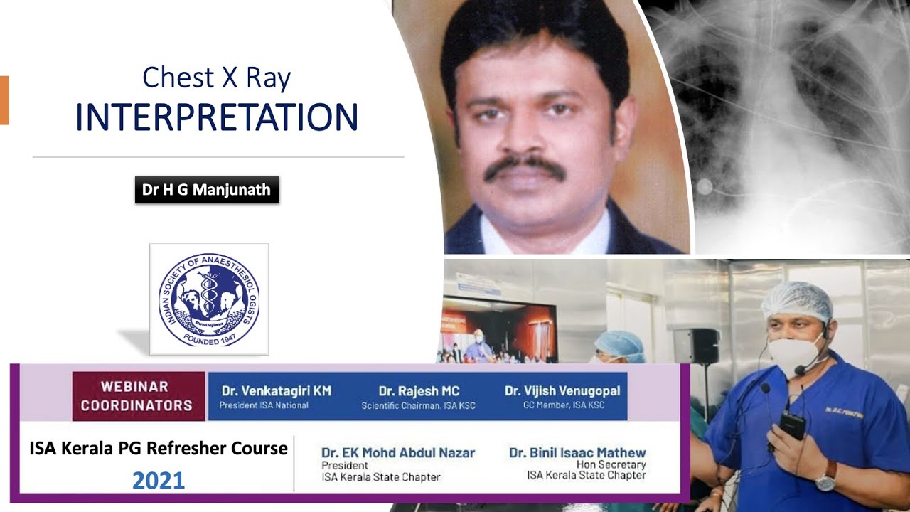 Chest X Rays Interpretation Dr H G Manjunath ISA Kerala PG