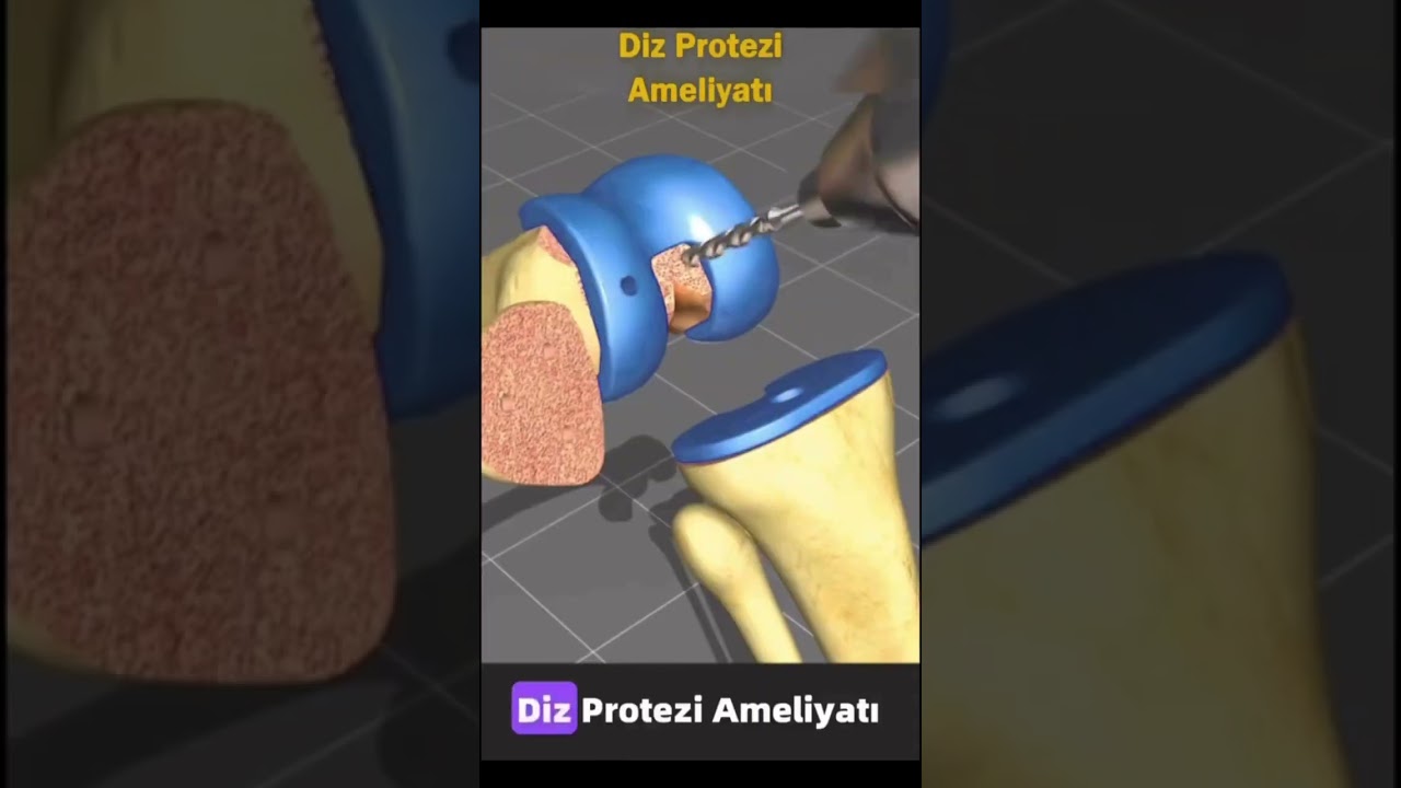 Ortopedi ve Travmatoloji — Protez ve Artroskopi