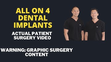 All on 4 Dental Implant Patient Surgery Video. How We Plan and Perform the Surgery