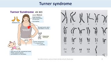 Sex detrmination and sex linked inheritance part 2