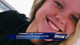 Fundraiser being held for burn victim