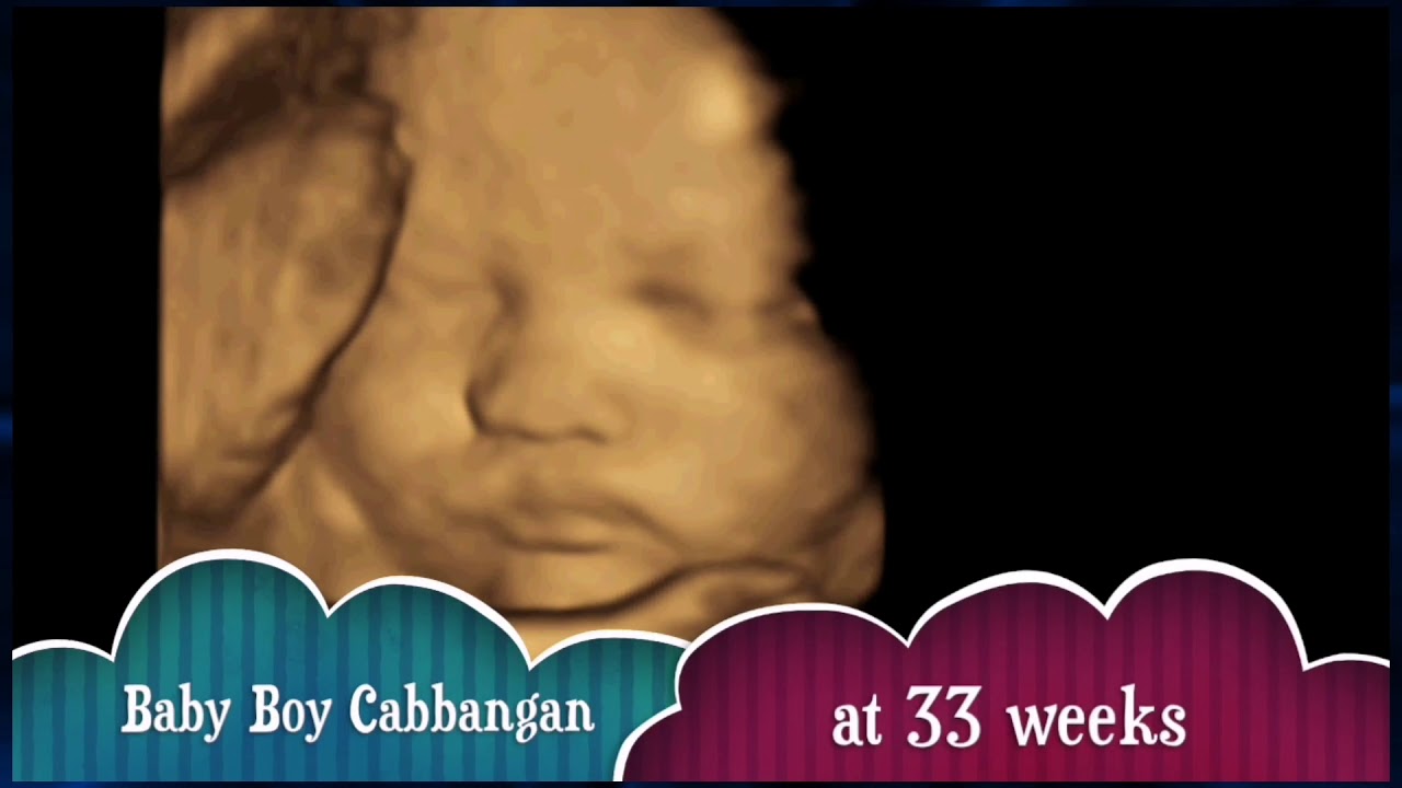 3d 4d Ultrasound / Baby Hiro 33weeks YouTube