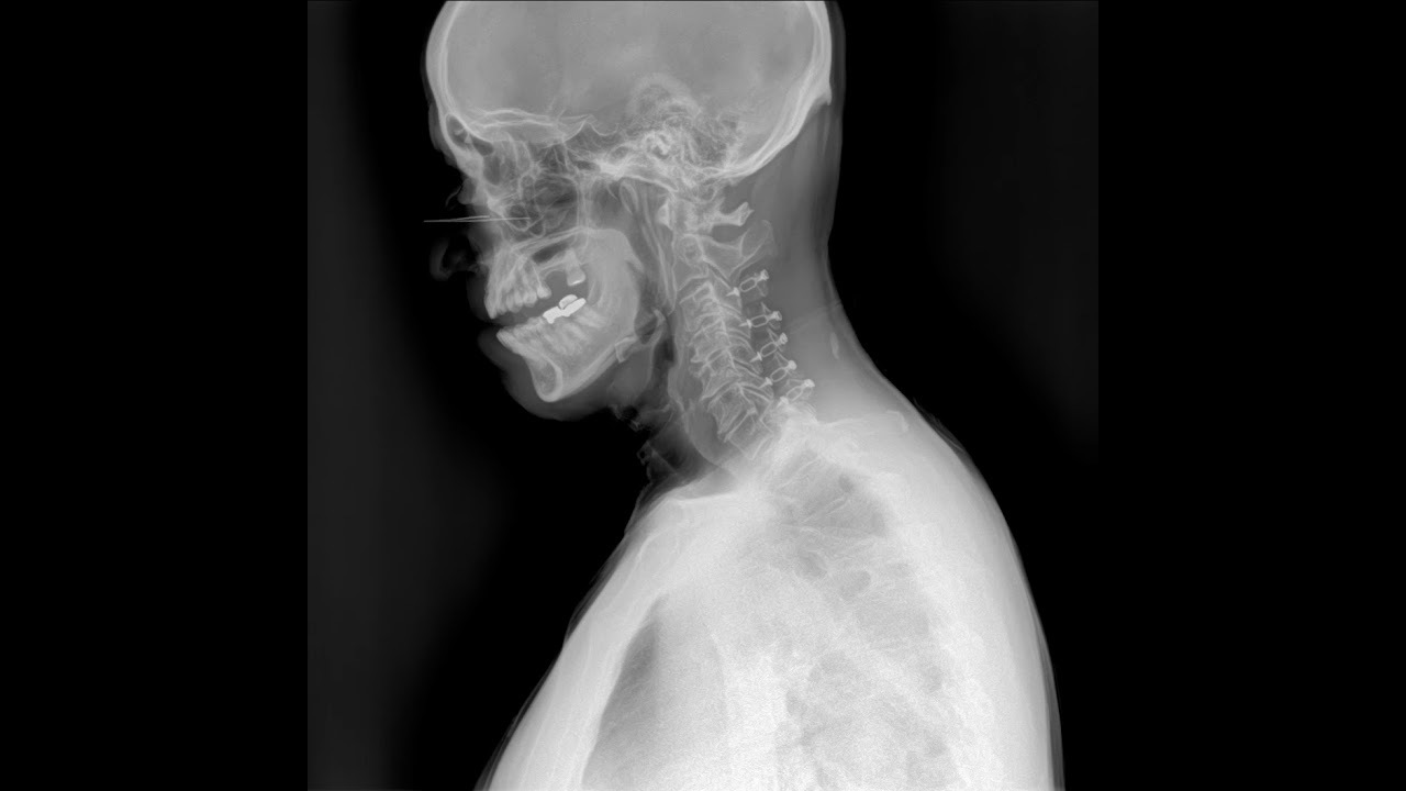 Dynamic Digital Radiography : SHIMADZU MEDICAL SYSTEMS USA