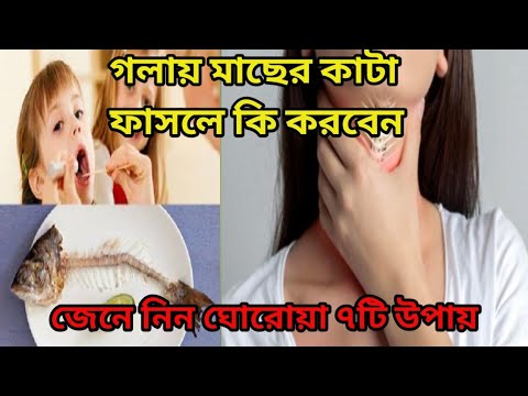 গলায় মাছের কাটা বিধলে কি করবেন। জেনে নিন ৭টি ভিন্নরকম কৌশল। Health Tips Bangla #health #tips