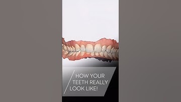 @me.my.chins.and.i shows you what your first Spark™ Clear Aligners appointment would look like.