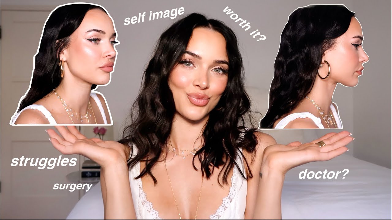 Обновление информации о ринопластике за 9 месяцев *самооценка, врач, трудности*