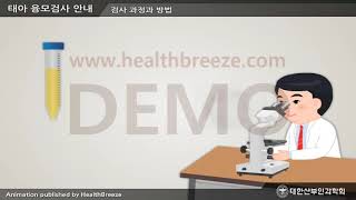 [시연용] b0035aako [대한산부인과학회] 태아 융모막 검사 안내