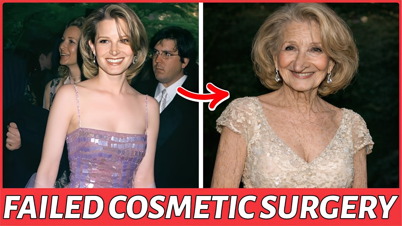 35 Beautiful Hollywood Actresses Ruined by Plastic Surgery