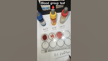 Blood typing or Blood grouping  Step by step #laboratory#medical #students #neet  #status #shorts