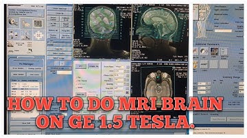 #How to do MRI Brain on GE 1.5 Tesla.