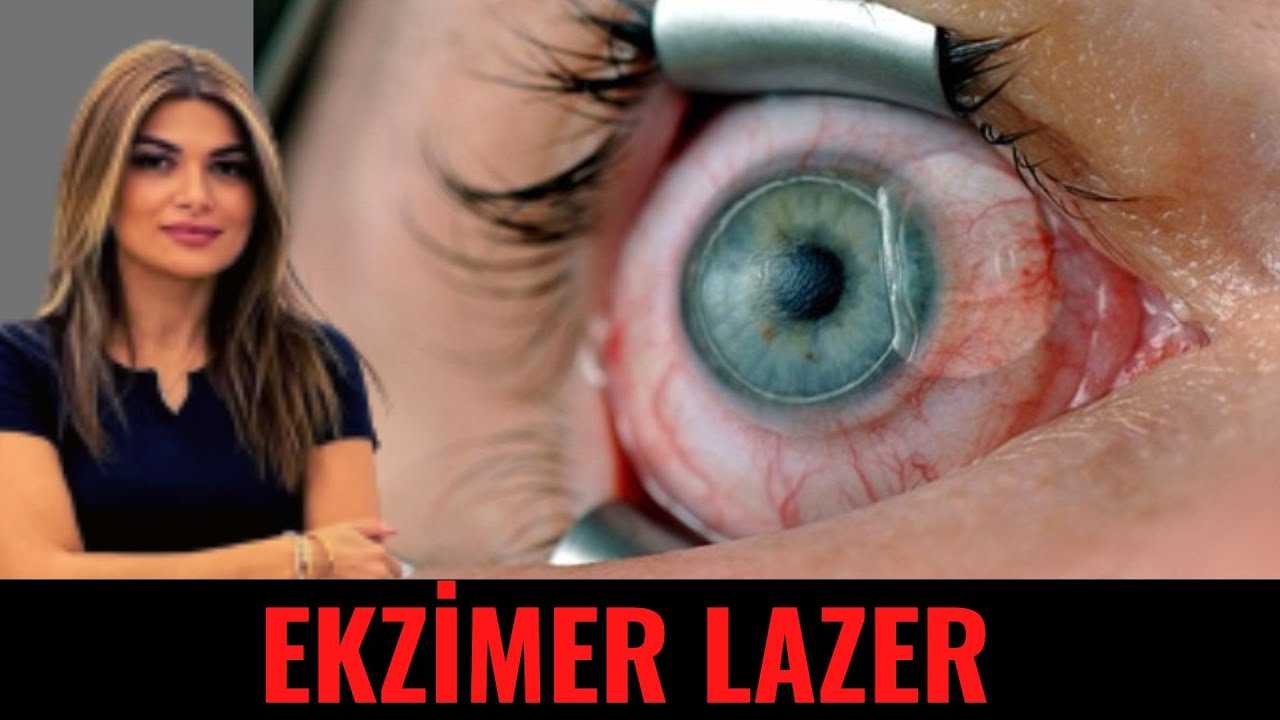 Ekzimer Lazer Nədir və Kimlərə Edilə Bilər?