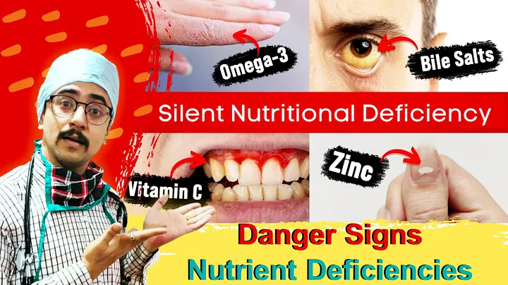 5 Signs Your Body is Deficient in Nutrients