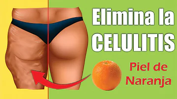 ¿Cuáles son los efectos secundarios de la piel de naranja?