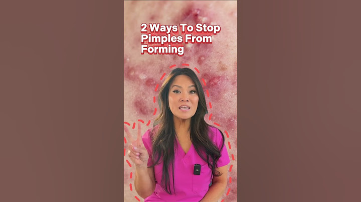2 Ways To Stop Pimples From Forming