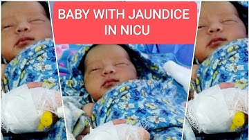 newborn baby in NICU || neonatal jaundice treatment|| baby with jaundice in NICU || NICU baby 🥺♥️❤️