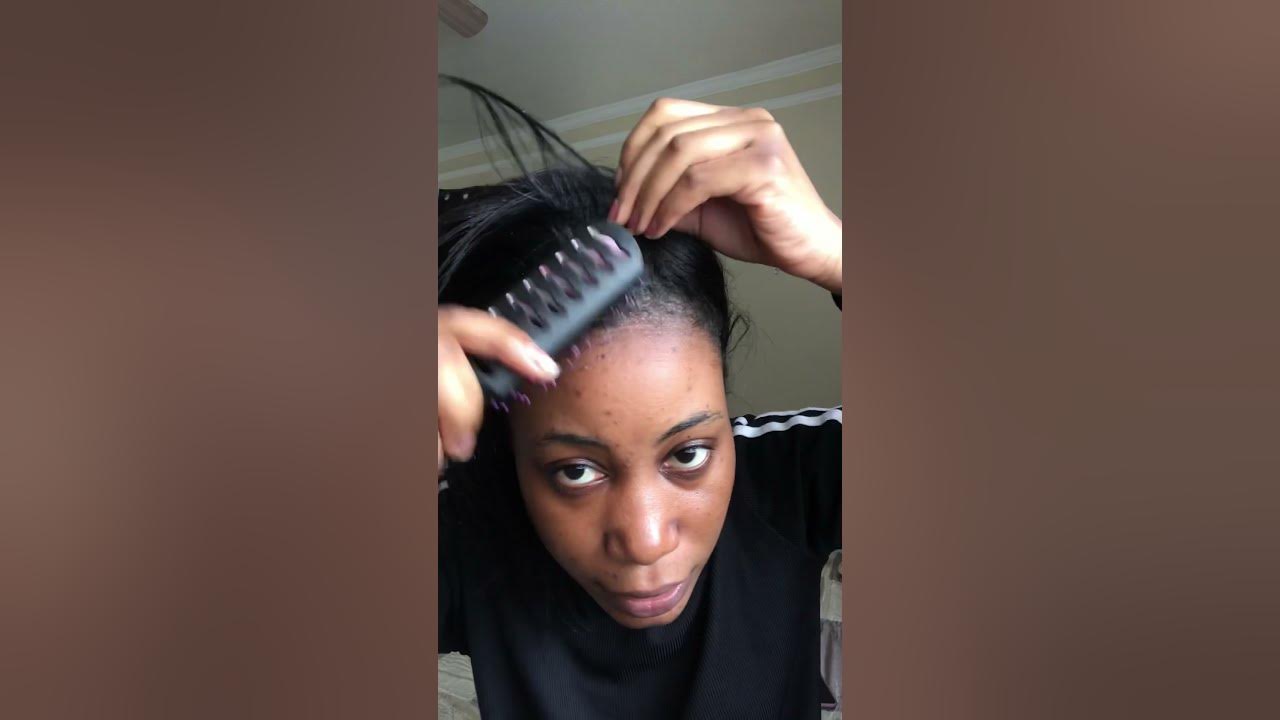update-relaxer-hair-burn-scalp-relaxerhair-hairburn-youtube