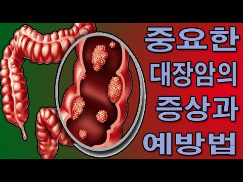 중요한 대장암의 증상과 예방법