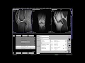 Knee MRI positioning