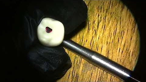 endo access assessment