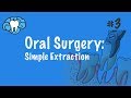 Oral Surgery | Simple Extraction | NBDE Part II