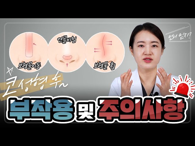 [코] 코 성형 후 부작용 및 주의사항 알아보기!