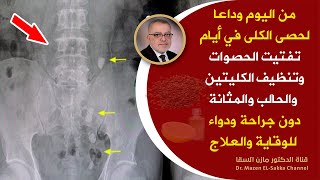 مشروب معجزة يفتت حصوات الكلى | من اليوم يمكن علاج حصوات الكلى في أيام ودعم الكلى والحالب والمثانة screenshot 3