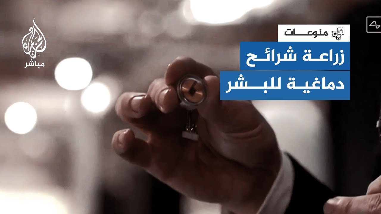 إيلون ماسك يبدأ في استقطاب متبرعين لتجربة زراعة الرقائق الدماغية